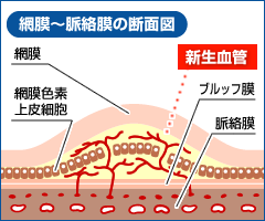 遠視のまま、放置しておくと