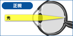 房水の流れ(健康な目の場合)