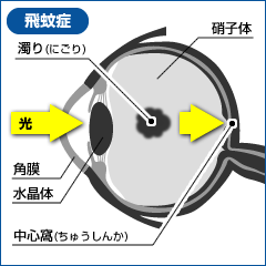 房水の流れ(健康な目の場合)